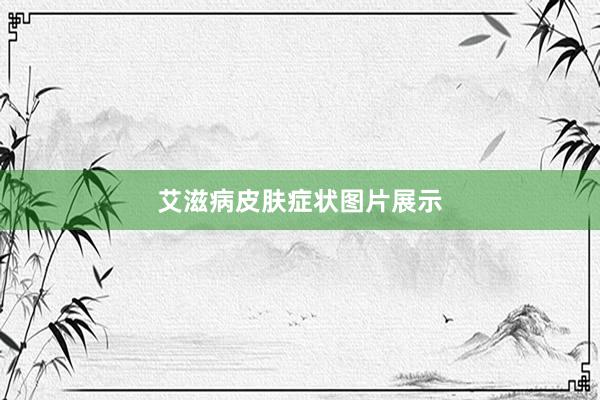 艾滋病皮肤症状图片展示